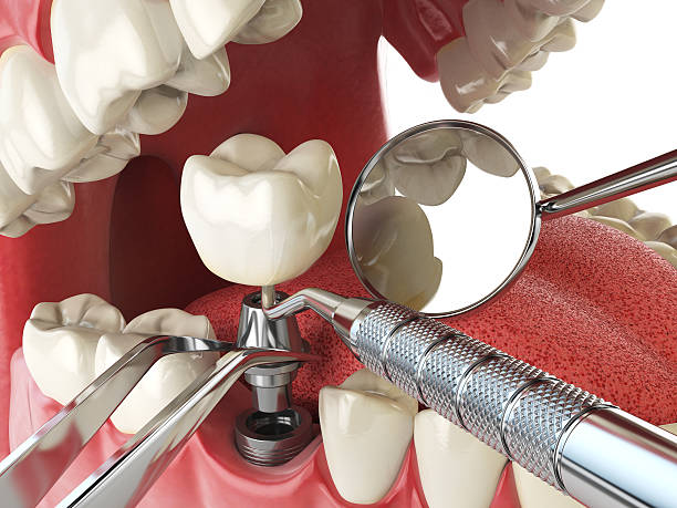 Best Emergency Treatment for Jaw Pain or Injury in Springville, IA